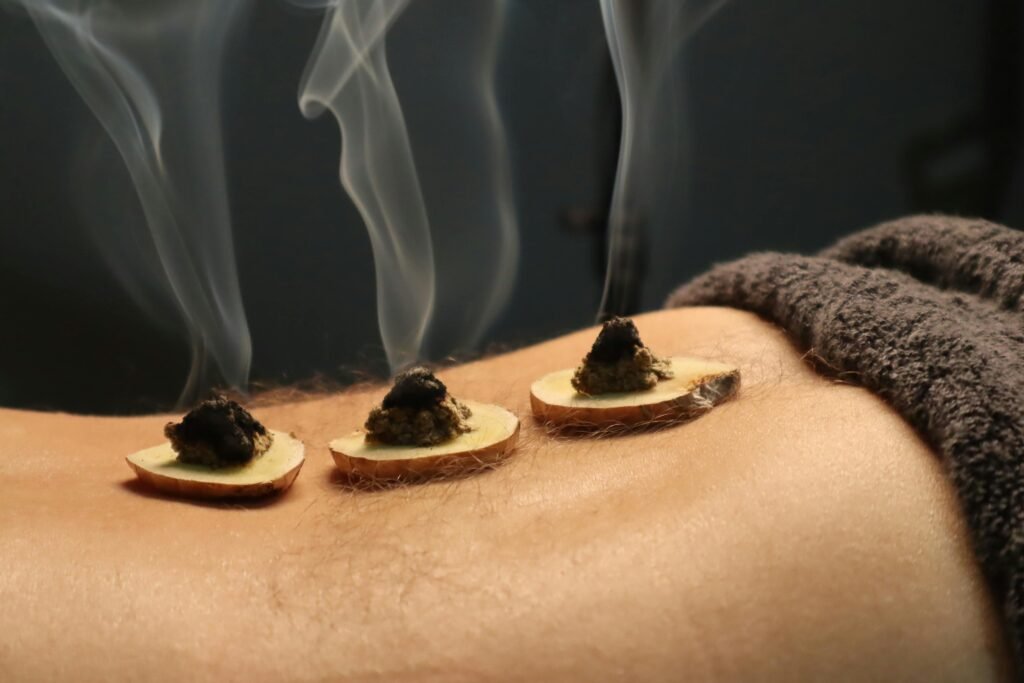 主页 22 Close-up of traditional moxibustion therapy with smoke rising from moxa cones.
